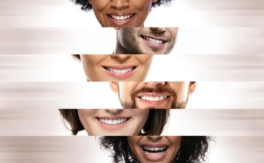 teeth whitening dubai