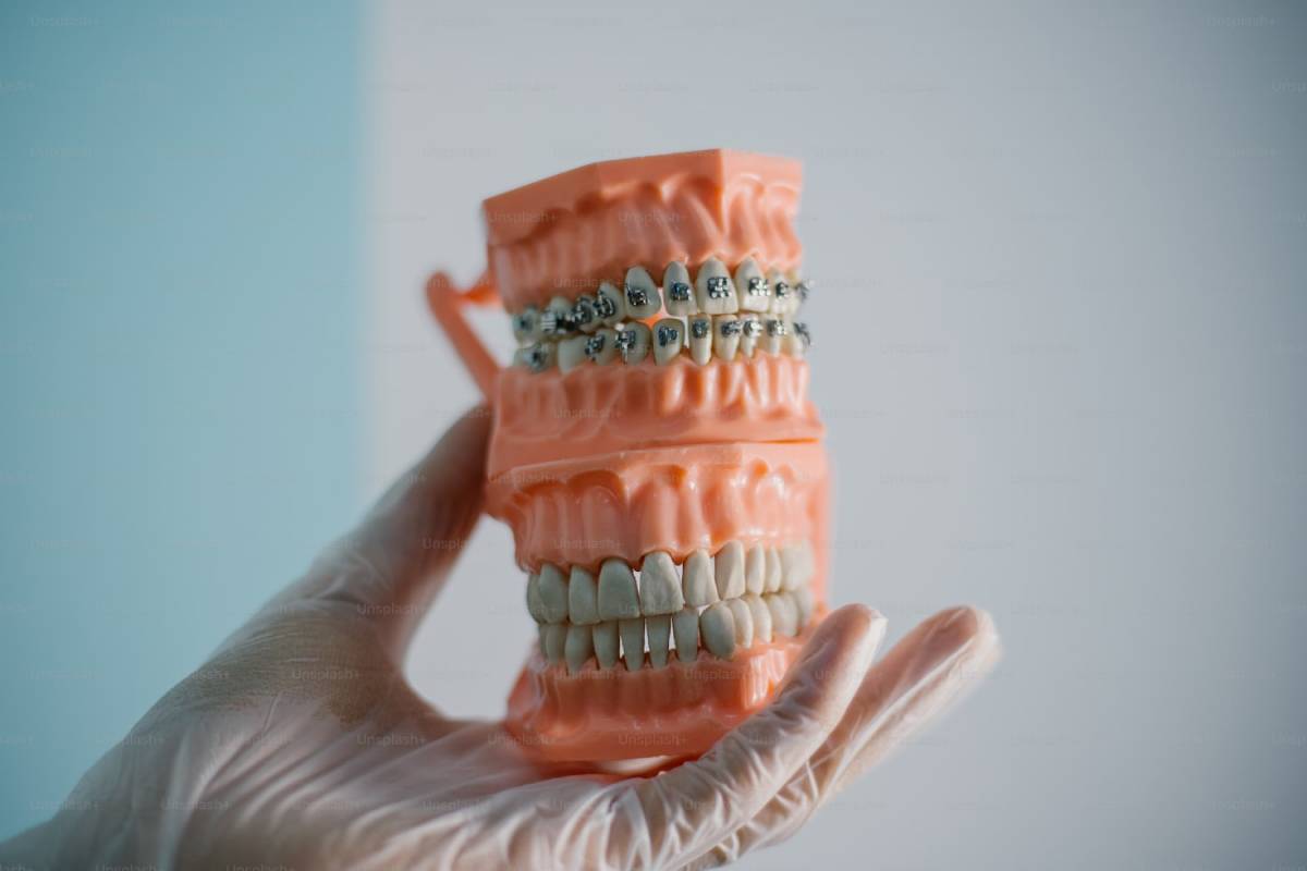 best braces dentist in Dubai