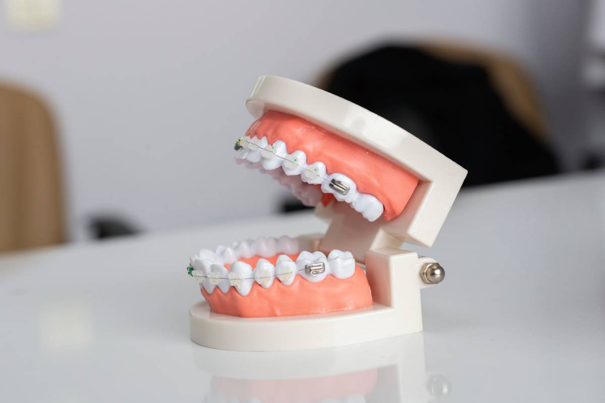 dental braces in Dubai