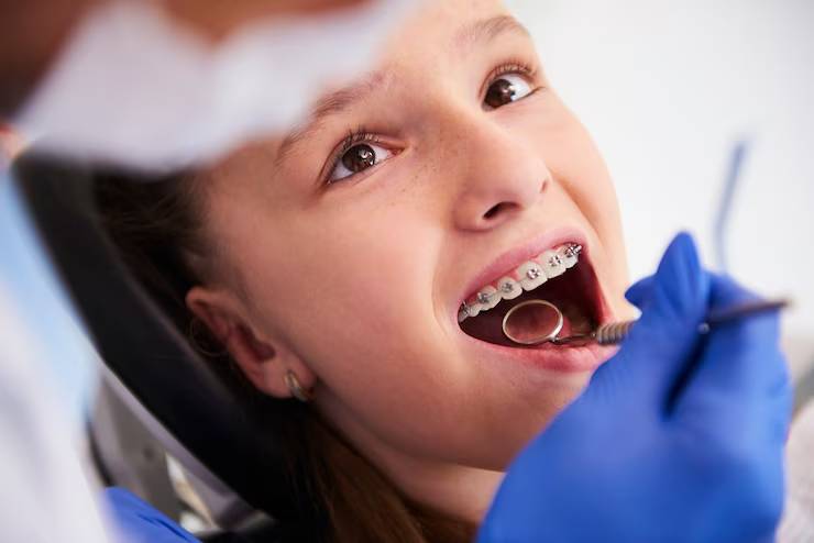metal braces Dubai