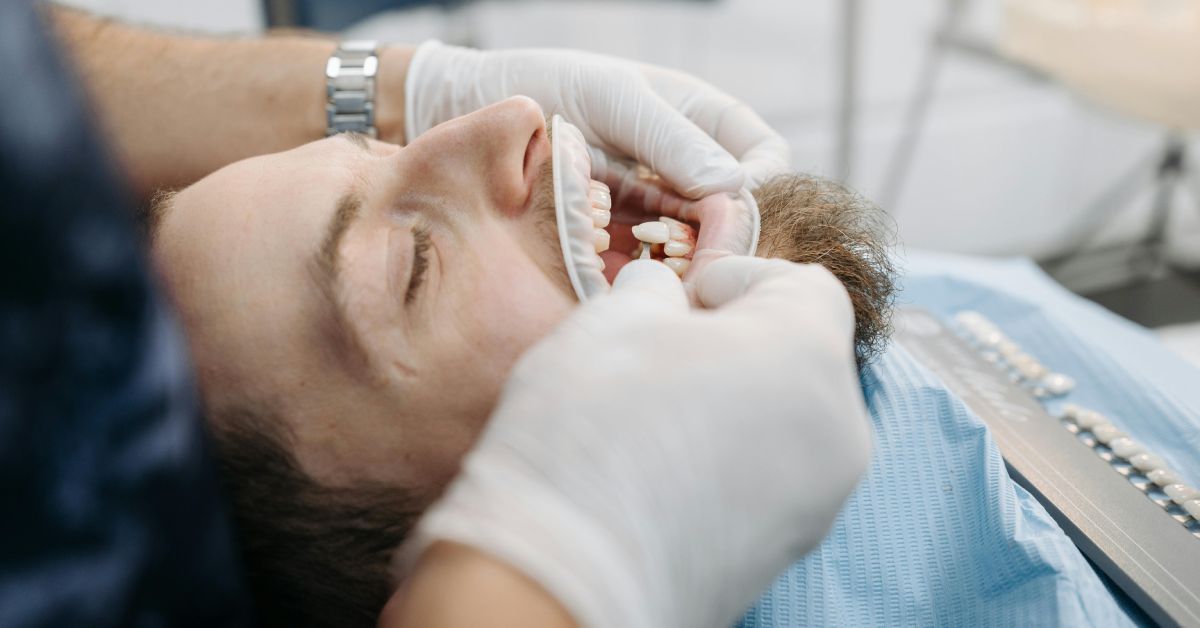 dental clinic for veneers