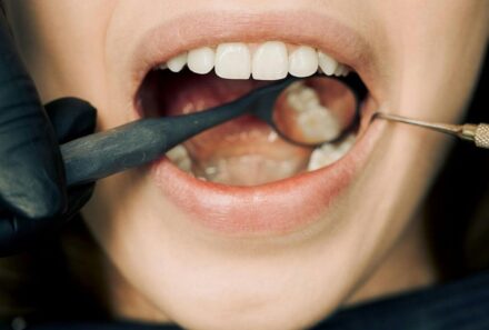 Best Zoom Teeth Whitening Clinic in Dubai: Your Complete 2025 Guide