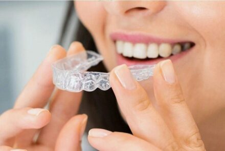 The Rise of Invisible Dental Braces in Dubai: How to Choose the Right Dental Treatment