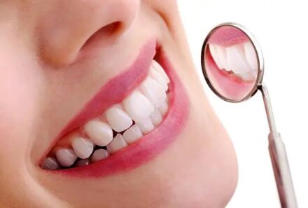 Veneers vs. Natural Teeth in Dubai: Making the Right Choice for Your Smile Makeover