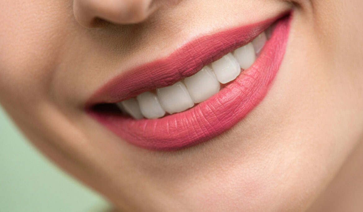 Opalescence Boost Teeth Whitening vs. Traditional Teeth Whitening: Why Dubai Patients Choose Advanced Technology