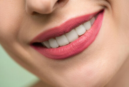 Opalescence Boost Teeth Whitening vs. Traditional Teeth Whitening: Why Dubai Patients Choose Advanced Technology