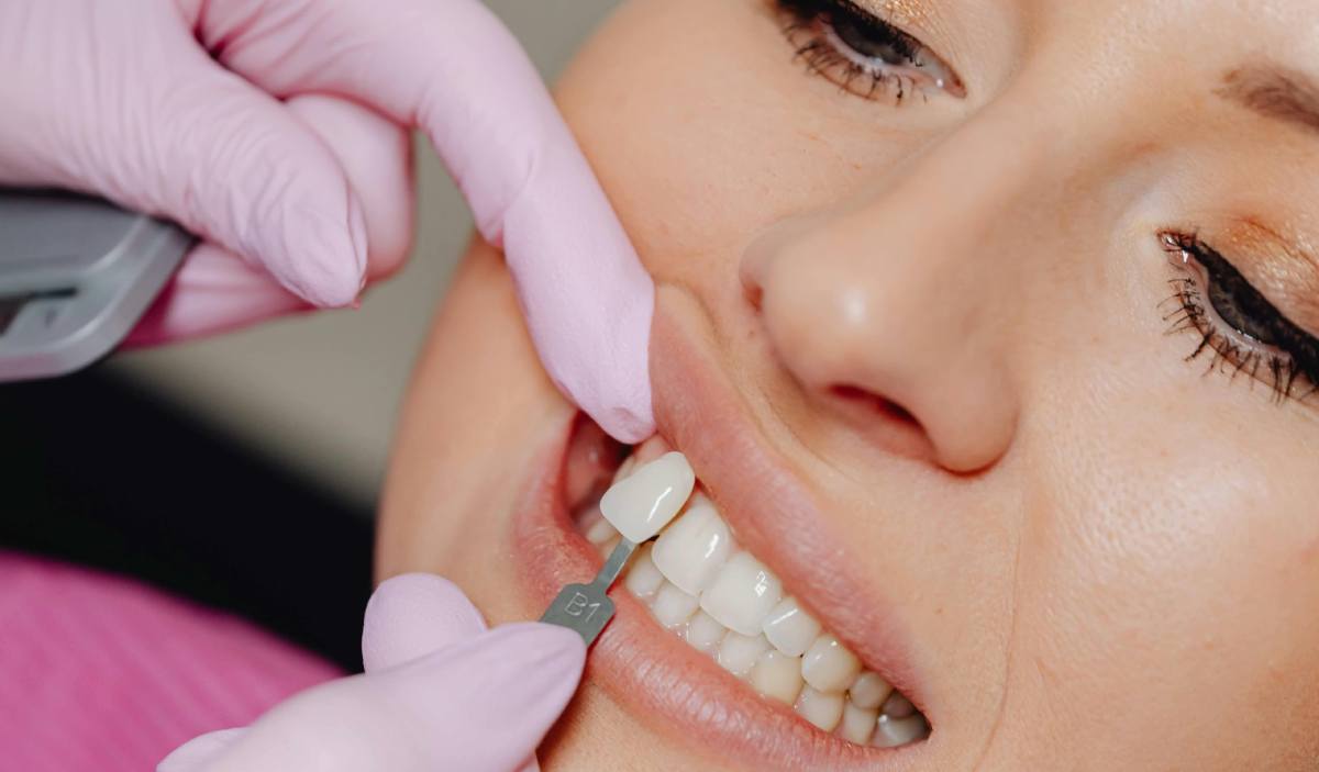 cosmetic dental clinic in Dubai