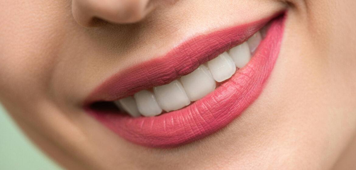 cosmetic smile makeover