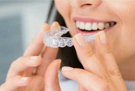 Best Dental Clinics for Invisalign in Dubai (2025 Guide): What to Look For & Why Many Patients Choose Dentists in Business Bay
