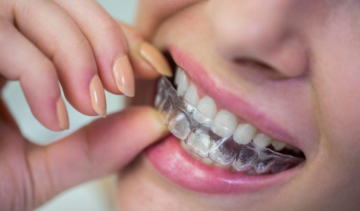 orthodontic treatment in dubai
