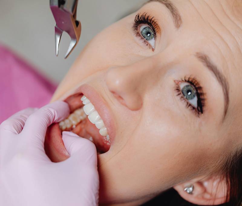 expert root canal specialists in dubai