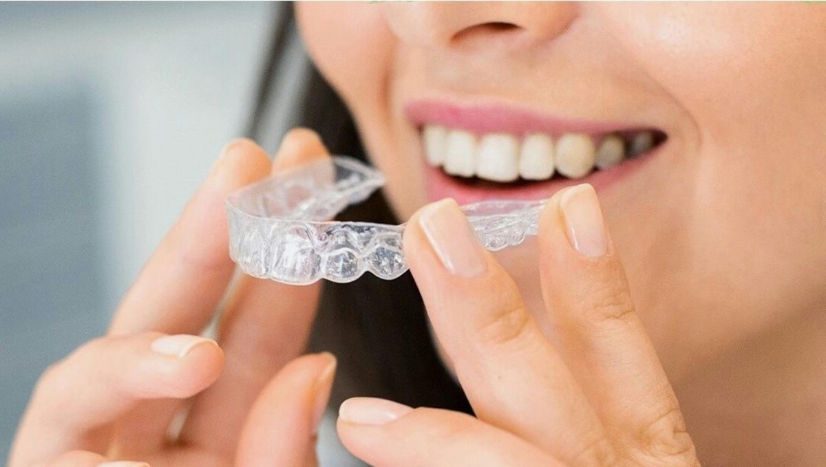 invisible braces in dubai