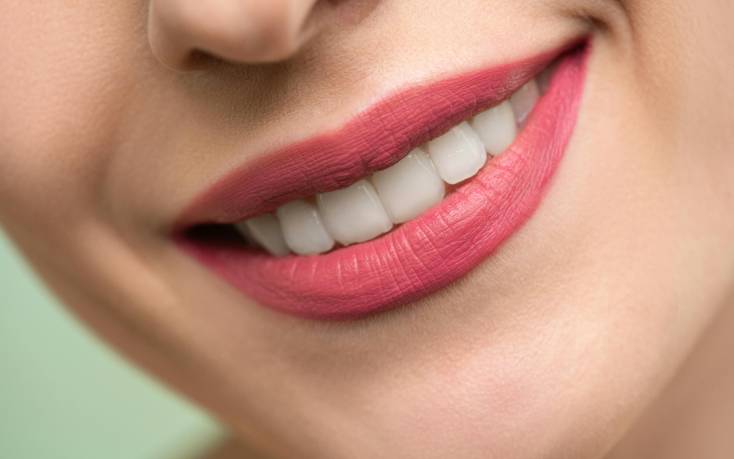 professional teeth whitening at bay avenue dental clinic