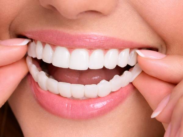 Dental Veneers in Dubai 13 veneer try in and final placement