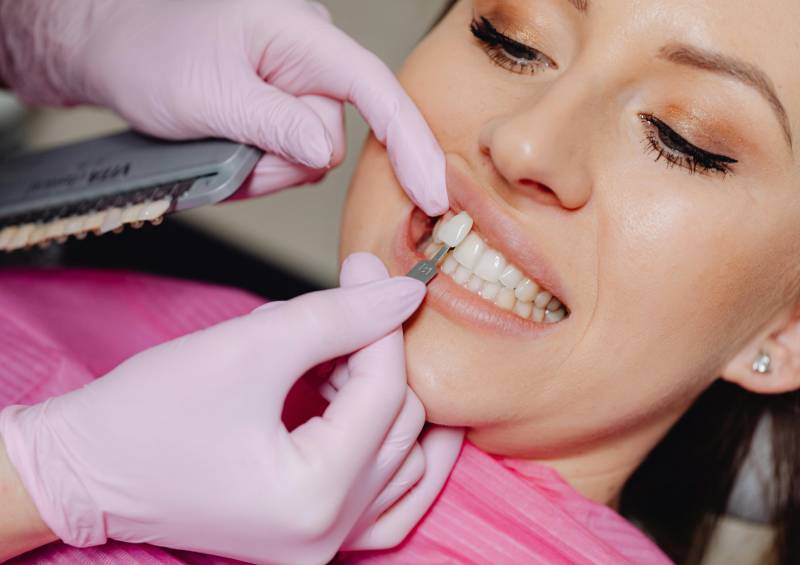 Dental Veneers in Dubai 2 what are dental veneers 1