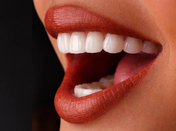 Professional Teeth Whitening Dubai 9 who needs teeth whitening
