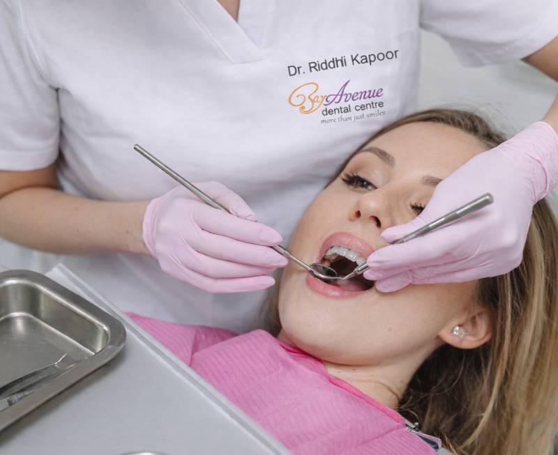 Dental Veneers in Dubai 14 why choose bay avenue dental centre for veneers treatment