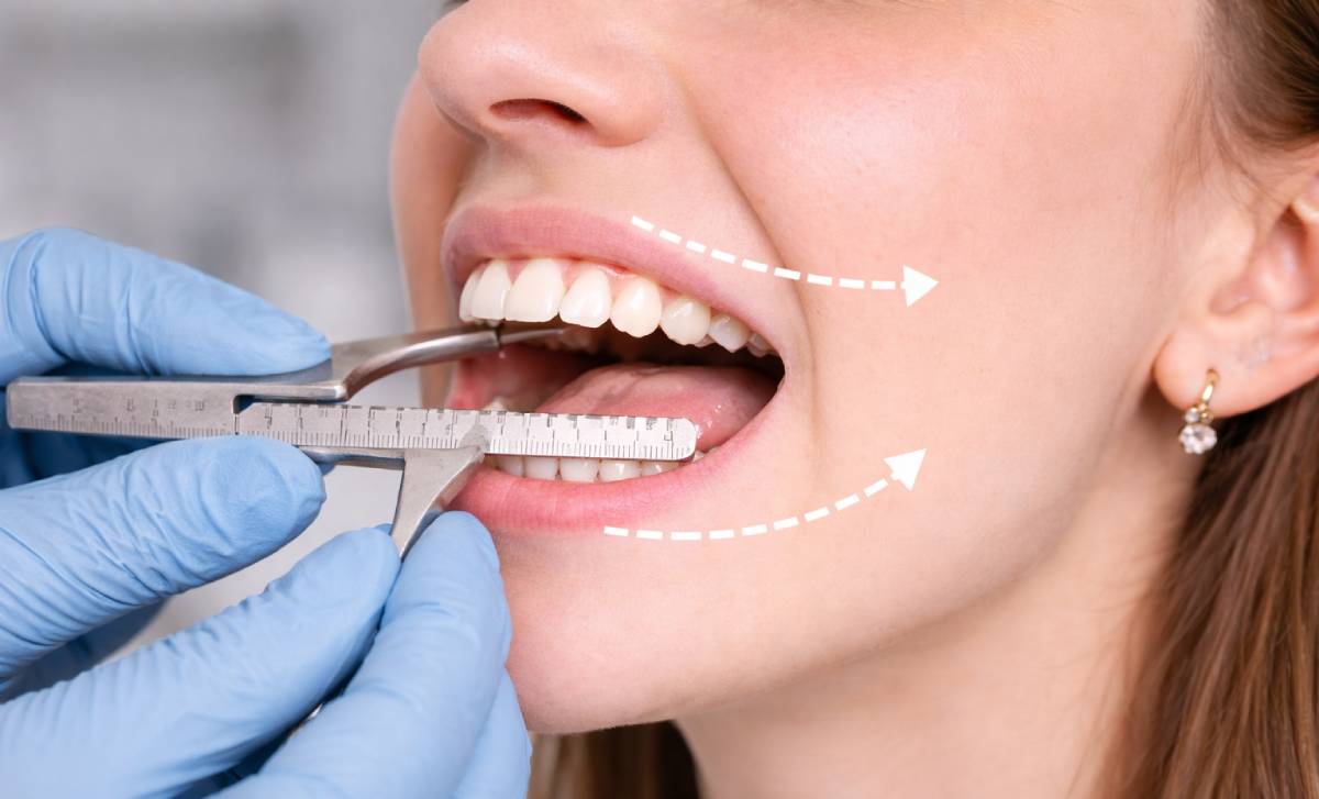 Jaw Alignment Orthodontist in Dubai: What to Expect in Your First Bite Assessment 1 jaw alignment treatment dubai