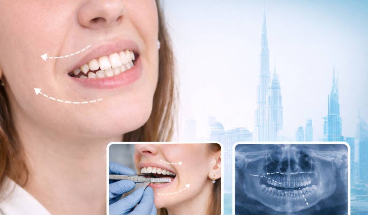 Uneven Jaw Correction in Dubai: Causes, Symptoms, and Treatment Options Complete Guide 2026