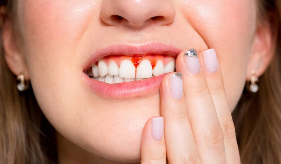 What is Gum Disease? Periodontal Disease Symptoms, Causes, Treatment, Prevention