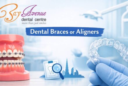 How to Choose the Best Orthodontist in Dubai for Dental Braces or Aligners