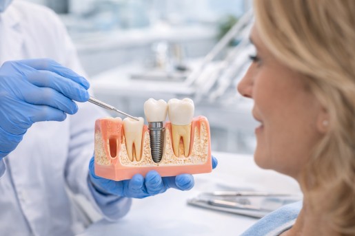 dental implant surgery