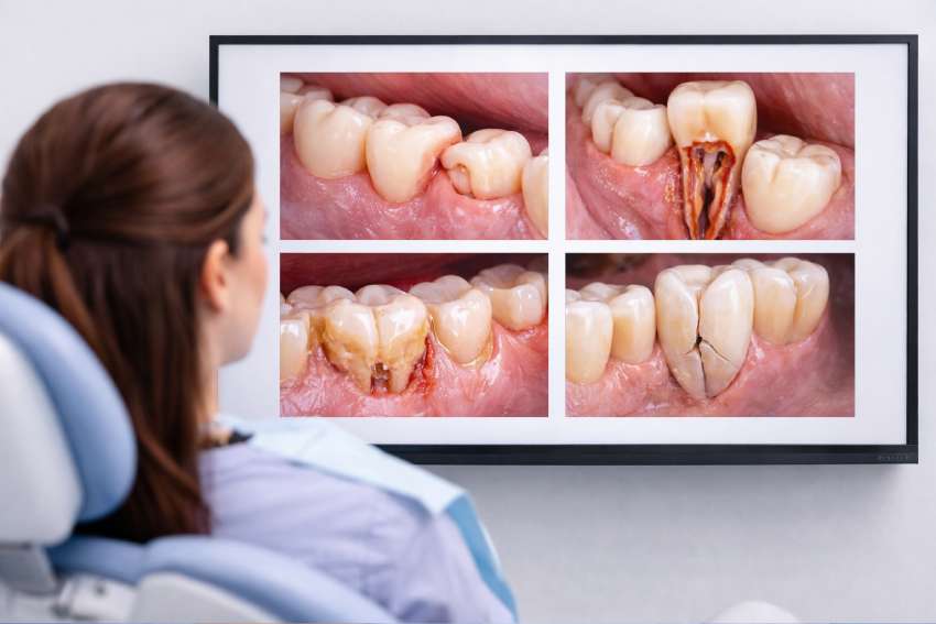 Dr. Chandan Prabhakar 11 dental treatment