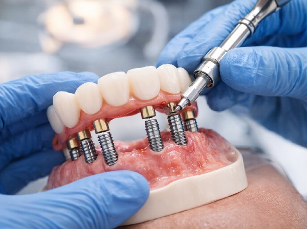 healing and osseointegration