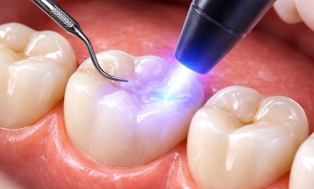 Same Day Dental Implants in Dubai 8 recovery after same day dental implants in dubai