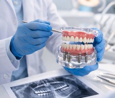 Same Day Dental Implants in Dubai 5 same day dental implants 1