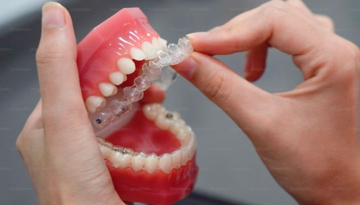 clear aligners cost in dubai