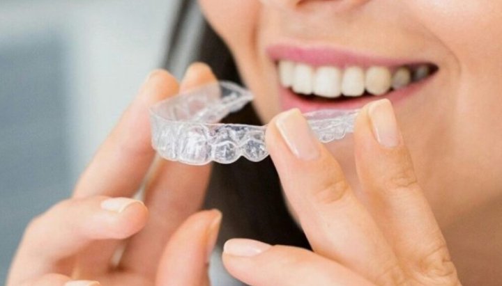 invisible braces in dubai 1