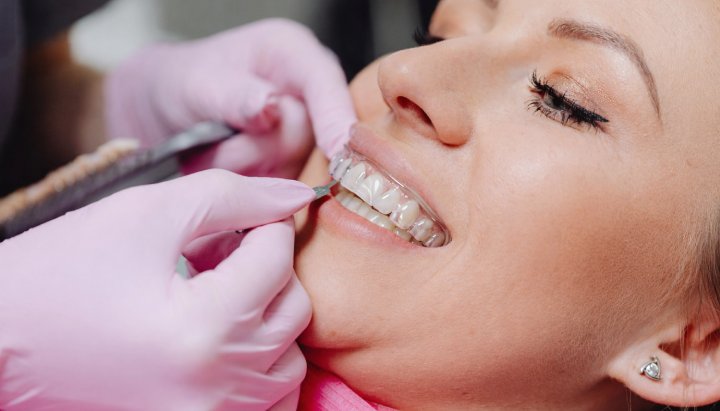 invisiblebraces cost in dubai