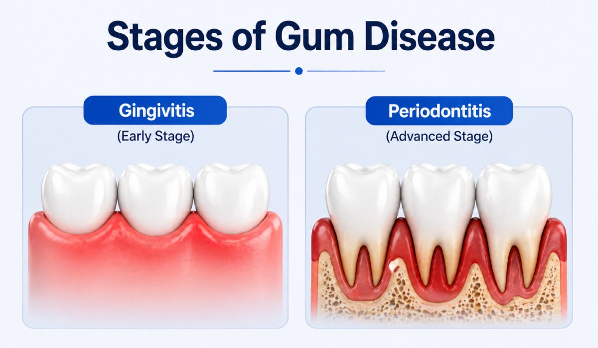 periodontics treatment Dubai