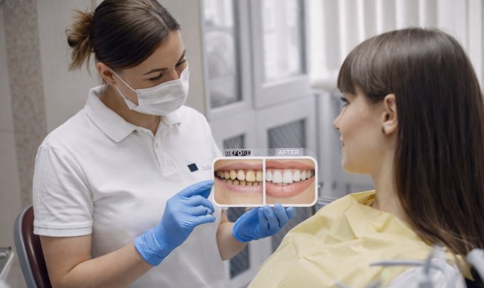 smile makeover cost in dubai