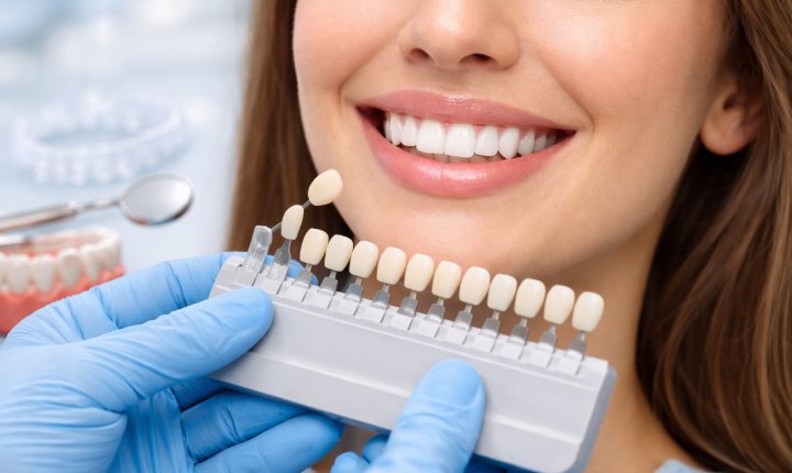 smile makeover in dubai