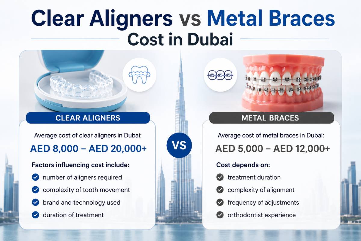 invisible aligners dubai