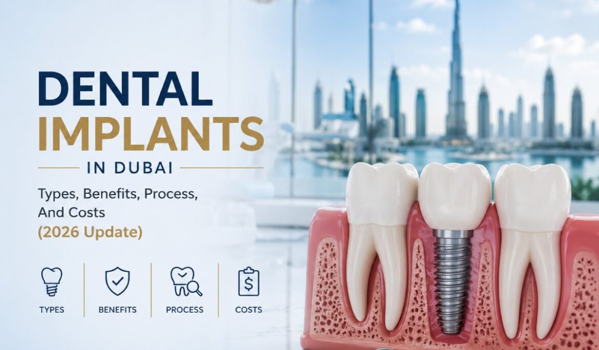 Dental Implants in Dubai: Types, Benefits, Process, And Costs (2026 Update)