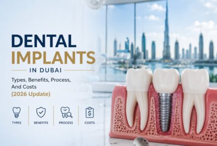 Dental Implants in Dubai: Types, Benefits, Process, And Costs (2026 Update)