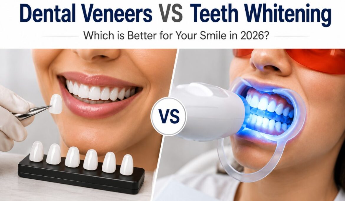 Dental Veneers vs Teeth Whitening: Which Is Better for Your Smile in 2026?